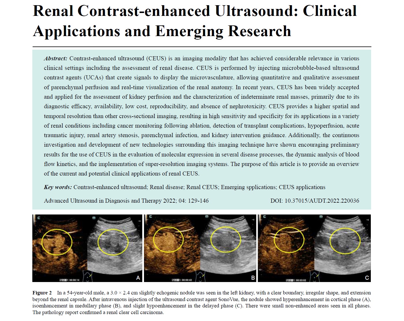 Renal Contrast-enhanced Ultrasound: Clinical Applications and Emerging Researc