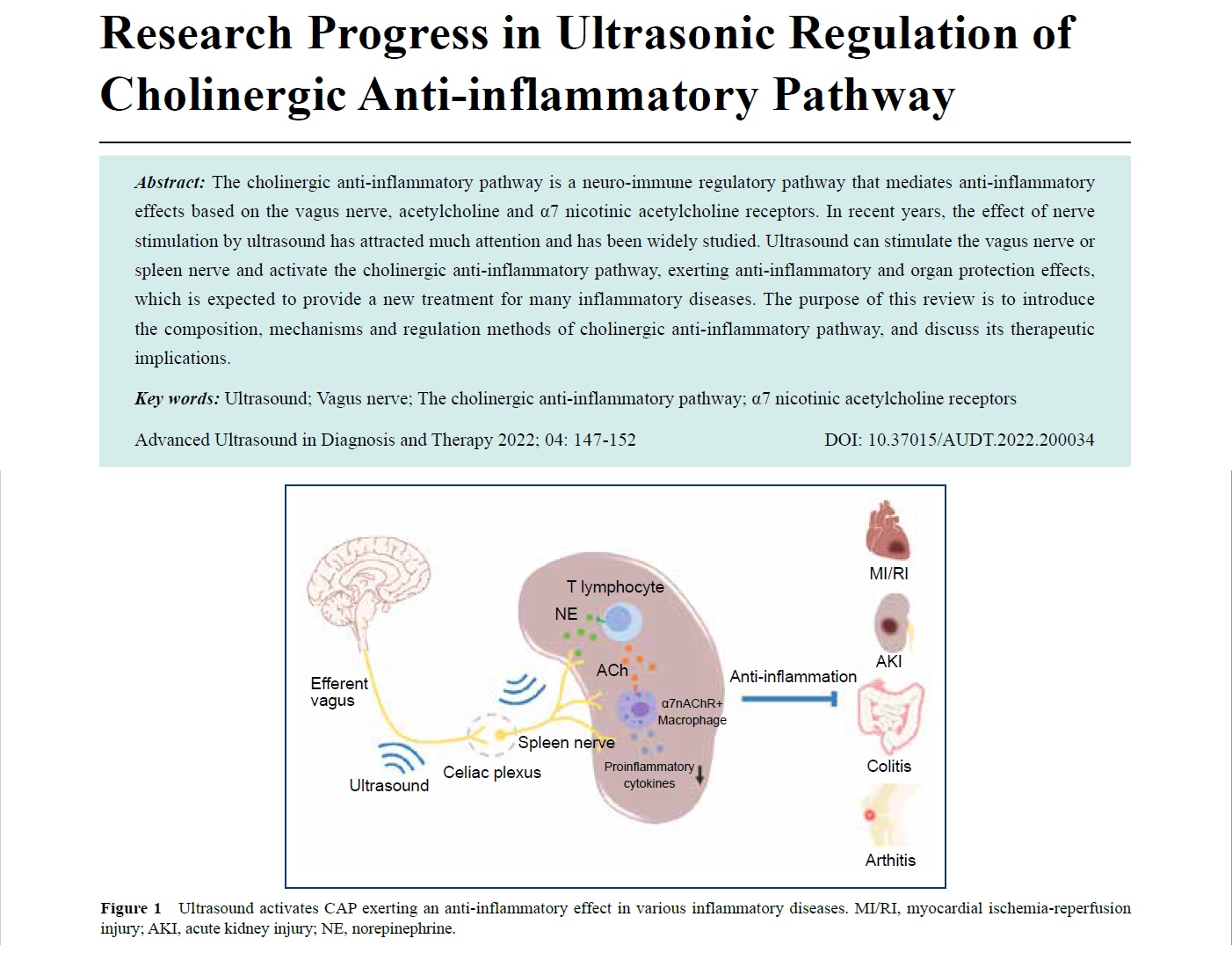 Research Progress in Ultrasonic Regulation of Cholinergic Anti-inflammatory Pathwa