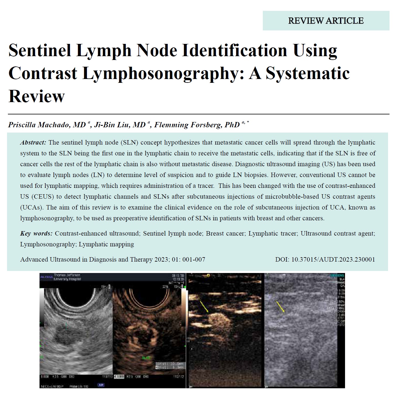 Sentinel Lymph Node Identification Using Contrast Lymphosonography: A Systematic Review