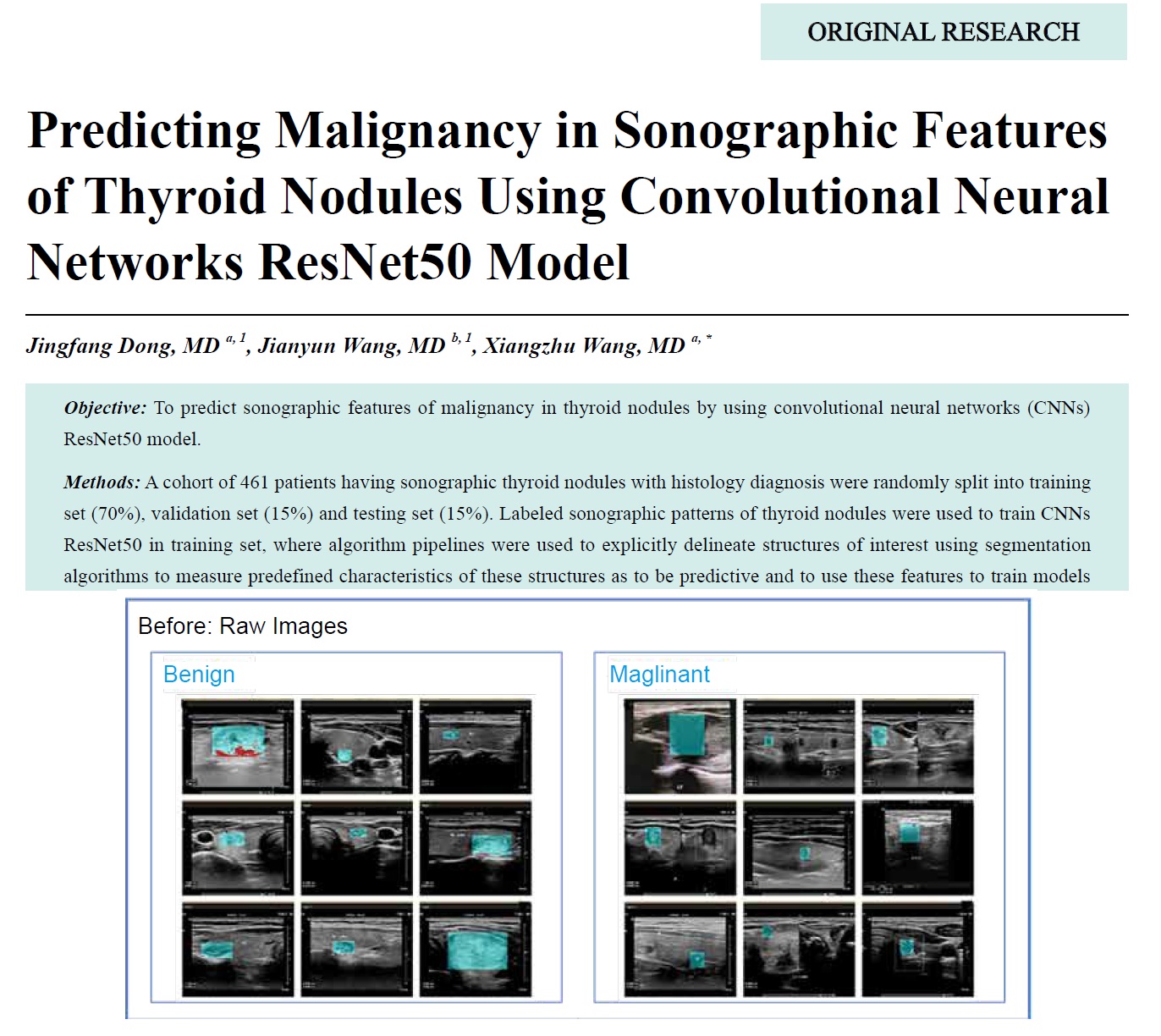 Predicting Malignancy in Sonographic Features of Thyroid Nodules Using Convolutional Neural Networks ResNet50 Model