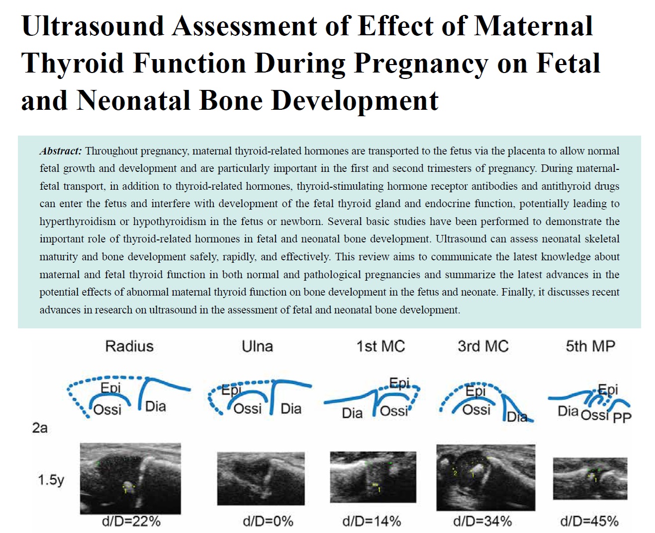 Ultrasound Assessment of Effect of Maternal Thyroid Function During Pregnancy on Fetal and Neonatal Bone Development